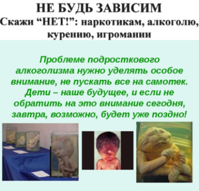 Алкоголизм и наркомания как социальная проблема Алкоголизм и наркомания как социальная проблема