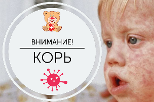 ВНИМАНИЕ: корь! Профилактика кори ВНИМАНИЕ: корь! Профилактика кори